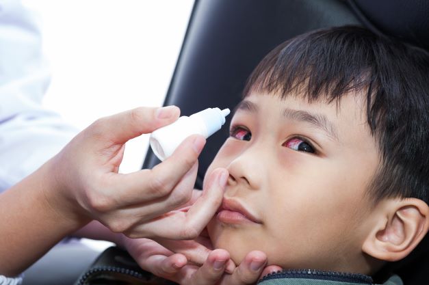 5 causas comuns de vermelhidão ocular em crianças