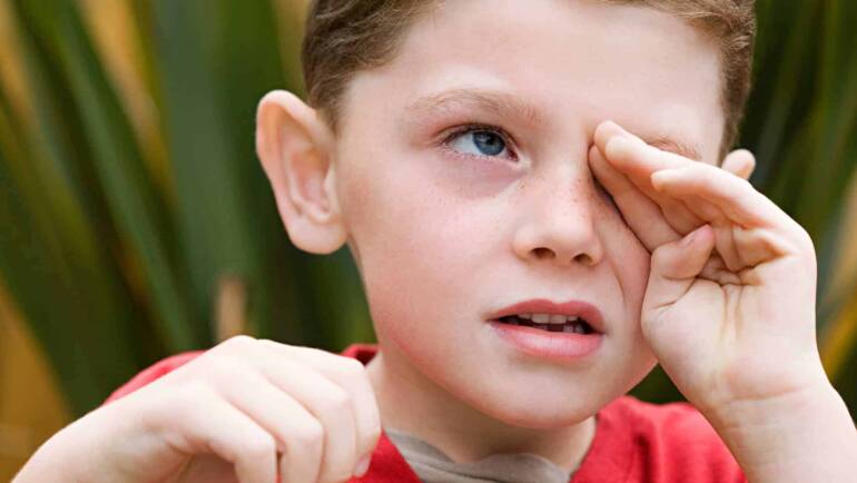 Conjuntivite alérgica em crianças – Tudo que você precisa saber
