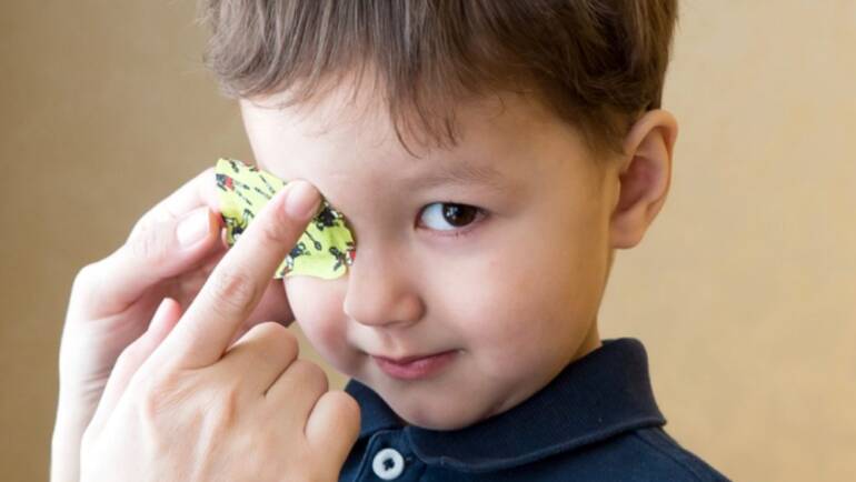Uso do Tampão para Tratar Olho Preguiçoso – Dicas para ajudar os pais