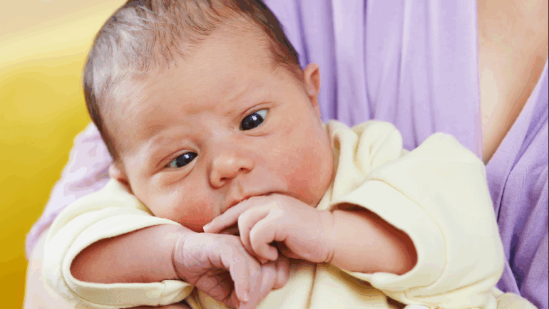 Cirurgia de estrabismo em bebês – Quais as indicações e como funciona